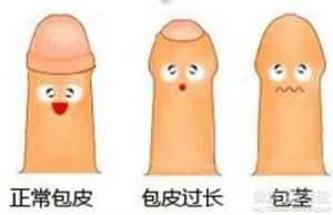 男性包皮过长有什么影响